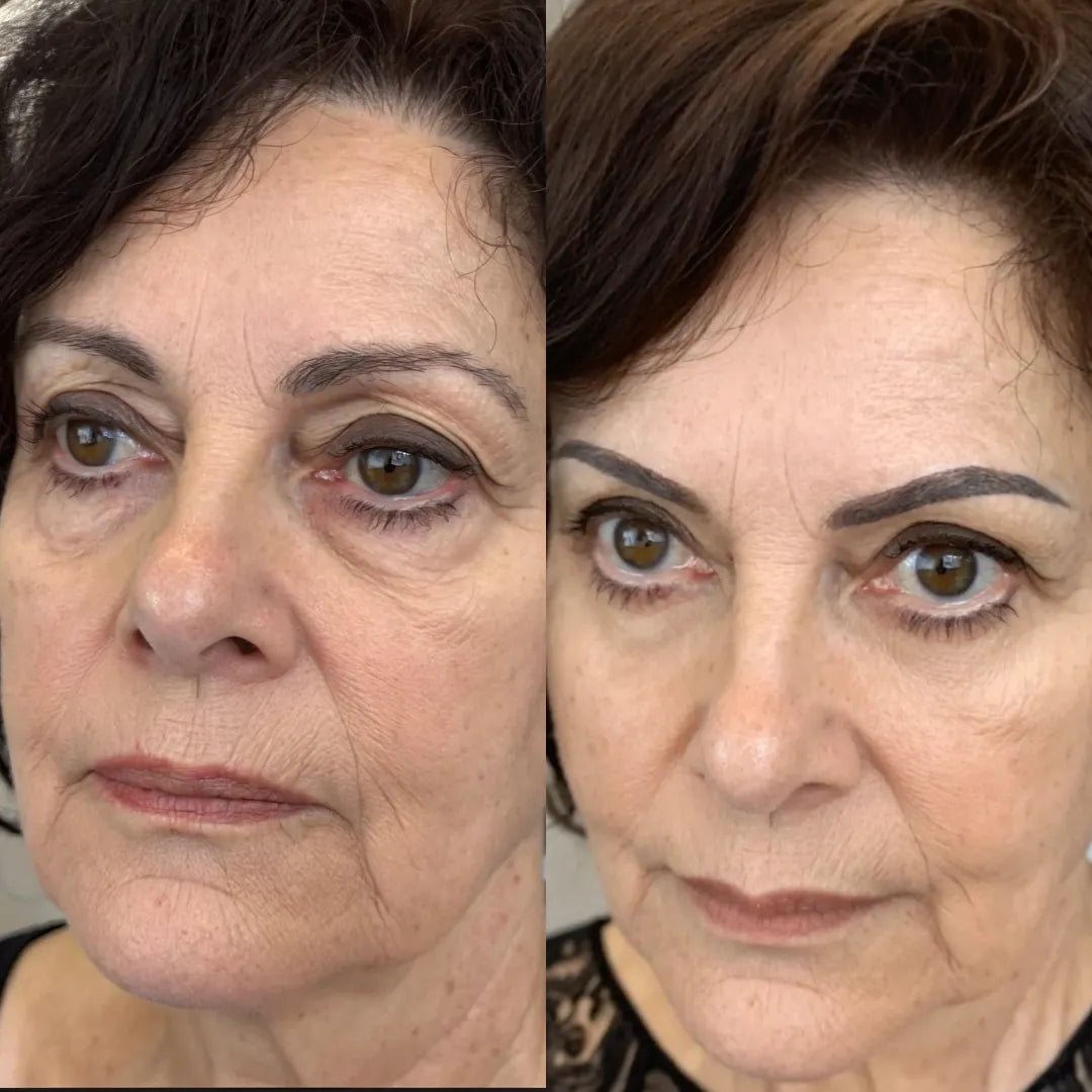 RevitalEyes® 2-in-1 Red Light Therapy + EMS To Erase Eye Bags