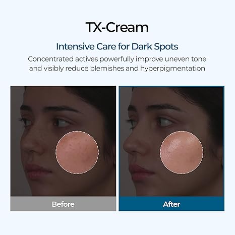 Dr Melaxin Tranexamic Cream | Skin freckle Cream, Anti-pigmetation For All Skin